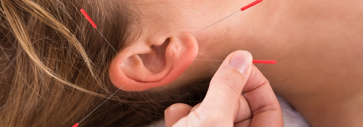 Chiropractic Calgary AB Woman Receiving Auricular Therapy